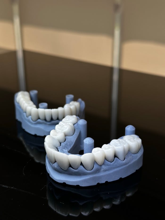 Two realistic dental impressions displayed on a shiny black surface with soft lighting.